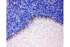 IHC-P: GAT-1 antibody testing of rat brain tissue (SLC6A1 抗体  (C-Term))
