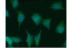 ICC/IF analysis of NUDT1 in A549 cells line, stained with DAPI (Blue) for nucleus staining and monoclonal anti-human NUDT1 antibody (1:100) with goat anti-mouse IgG-Alexa fluor 488 conjugate (Green). (NUDT1 抗体)