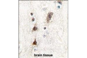 Immunohistochemistry (Paraffin-embedded Sections) (IHC (p)) image for anti-Pancreas Specific Transcription Factor, 1a (PTF1A) (AA 12-43), (N-Term) antibody (ABIN1881703)