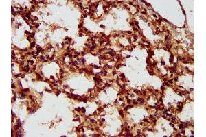 IHC image of ABIN7158336 diluted at 1:300 and staining in paraffin-embedded human lung tissue performed on a Leica BondTM system. (LMCD1 抗体  (AA 105-268))