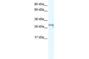 Human Jurkat; WB Suggested Anti-SHOX2 Antibody Titration: 0. (SHOX2 抗体  (Middle Region))