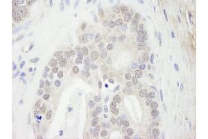 Immunohistochemistry (IHC) image for anti-Multiple Endocrine Neoplasia 1 (MEN1) (C-Term) antibody (ABIN7448666)