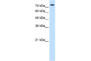 WB Suggested Anti-FOXK1 Antibody Titration:  0. (Foxk1 抗体  (Middle Region))