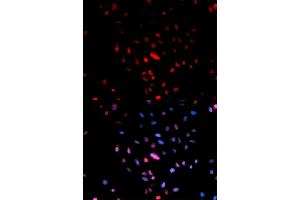 Immunofluorescence analysis of U2OS cells using Phospho-Jun-S73 antibody (ABIN5969904). (C-JUN 抗体  (pSer73, Ser73))