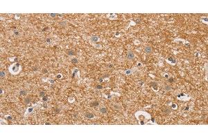 Immunohistochemistry of paraffin-embedded Human brain using CYP4A11 Polyclonal Antibody at dilution of 1:30 (CYP4A11 抗体)