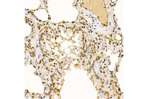 Immunohistochemistry of paraffin-embedded rat lung using UBB Rabbit pAb (ABIN6130181, ABIN6149775, ABIN6149776 and ABIN6222958) at dilution of 1:200 (40x lens).