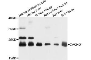 Western blot analysis of extracts of various cell lines, using CACNG1 antibody.