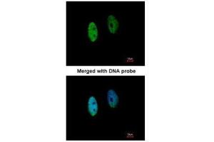 ICC/IF Image Immunofluorescence analysis of paraformaldehyde-fixed HeLa, using DENND1B, antibody at 1:200 dilution. (DENND1B 抗体  (Center))