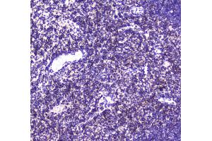 IHC analysis of CBFb using anti-CBFb antibody .