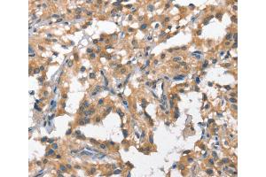 Immunohistochemistry (IHC) image for anti-Hepatocyte Growth Factor (Hepapoietin A, Scatter Factor) (HGF) antibody (ABIN2421656) (HGF 抗体)