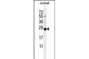 POLR2J 抗体  (C-Term)