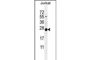 POLR2J Antibody (C-Term) (ABIN655247 and ABIN2844848) western blot analysis in Jurkat cell line lysates (35 μg/lane). (POLR2J 抗体  (C-Term))