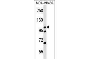 Western Blotting (WB) image for anti-Catenin (Cadherin-Associated Protein), delta 2 (Neural Plakophilin-Related Arm-Repeat Protein (CTNND2) (AA 1131-1159), (C-Term) antibody (ABIN656479)