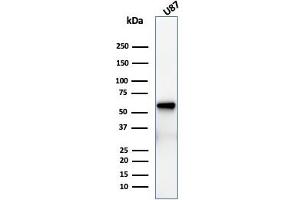 Western Blot Analysis of U87 cell lysate using NGFR Recombinant Mouse Monoclonal Antibody (rNGFR/1965). (Recombinant NGFR 抗体  (AA 281-421))