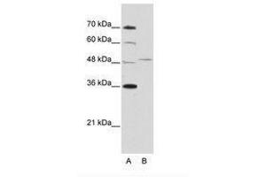 Image no. 2 for anti-Forkhead Box Q1 (FOXQ1) (AA 29-78) antibody (ABIN202435) (FOXQ1 抗体  (AA 29-78))
