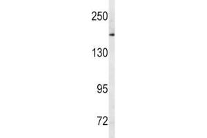 Western blot analysis of MRP1 antibody and human Ramos lysate. (ABCC1 抗体  (AA 1247-1275))