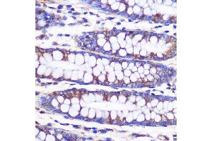 Immunohistochemistry (IHC) image for anti-NIMA (Never in Mitosis Gene A)- Related Kinase 9 (NEK9) (AA 730-979) antibody (ABIN7268914)