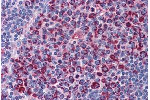 Human Tonsil: Formalin-Fixed, Paraffin-Embedded (FFPE) (SH3BP5 抗体  (AA 4-113))