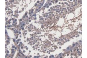 DAB staining on IHC-P; Samples: Mouse Testis Tissue (TRERF1 抗体  (AA 785-942))