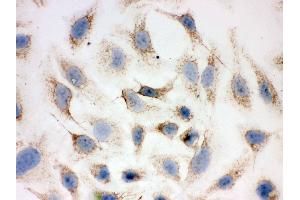 Immunohistochemistry (IHC) image for anti-Peroxiredoxin 3 (PRDX3) (AA 110-256) antibody (ABIN3043904)