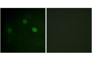 Immunofluorescence analysis of COS7 cells, using CDK1/CDC2 (Phospho-Thr14) Antibody. (CDK1 抗体  (pThr14))