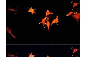 Immunofluorescence analysis of C6 cells using MST1 Polyclonal Antibody at dilution of 1:100. (MST1 抗体)