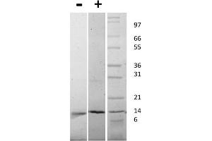 SDS-PAGE of Mouse Nerve Growth Factor beta Recombinant Protein SDS-PAGE of Mouse Nerve Growth Factor beta Recombinant Protein. (NGFB 蛋白)