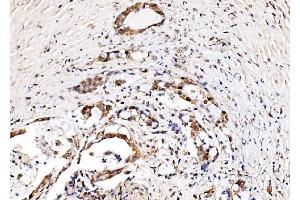 IHC analysis of IFI16 using anti-IFI16 antibody (ABIN7600374). (IFI16 抗体  (AA 183-743))