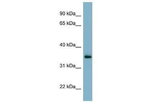 GEM antibody used at 1 ug/ml to detect target protein. (GEM 抗体  (N-Term))