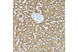 Immunohistochemistry (IHC) image for anti-Glycyl-tRNA Synthetase (GARS) (AA 60-370) antibody (ABIN6140964)