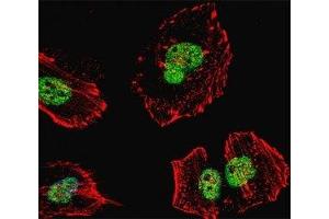 Fluorescent confocal image of HeLa cell stained with Nucleolin antibody at 1:25. (Nucleolin 抗体)