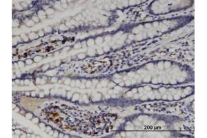 Image no. 1 for anti-Mannosyl (Alpha-1,6-)-Glycoprotein beta-1,6-N-Acetyl-Glucosaminyltransferase (MGAT5) (AA 642-740) antibody (ABIN599401) (MGAT5 抗体  (AA 642-740))