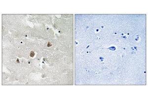 Immunohistochemistry (IHC) image for anti-Mitogen-Activated Protein Kinase Kinase Kinase 1 (MAP3K1) (pThr1402) antibody (ABIN1847608) (MAP3K1 抗体  (pThr1402))