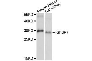 Western blot analysis of extracts of various cell lines, using IGFBP7 antibody (ABIN6293120) at 1:1000 dilution. (IGFBP7 抗体)