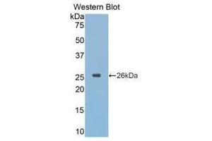 Western blot analysis of recombinant Simian CTSK. (Cathepsin K 抗体  (AA 116-329))