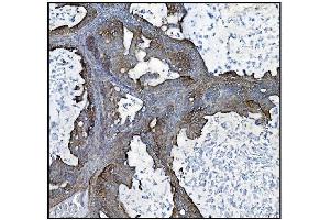 IHC analysis of CLPP using anti-CLPP antibody (ABIN5693176).