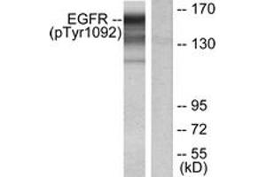 Western Blotting (WB) image for anti-Epidermal Growth Factor Receptor (EGFR) (pTyr1092) antibody (ABIN2888397) (EGFR 抗体  (pTyr1092))