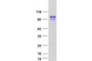 Validation with Western Blot