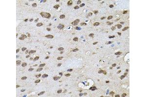 Immunohistochemistry of paraffin-embedded Rat brain using RNF166 Polyclonal Antibody (RNF166 抗体)