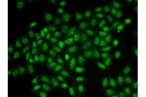 Immunofluorescence analysis of HeLa cells using COIL antibody (ABIN5973828). (Coilin 抗体)