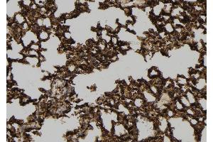 ABIN6278981 at 1/100 staining Mouse lung tissue by IHC-P. (NKIRAS1 抗体  (C-Term))