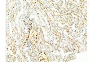ABIN6256011 and ABIN6267476 at 1/100 staining Mouse kidney tissue by IHC-P.