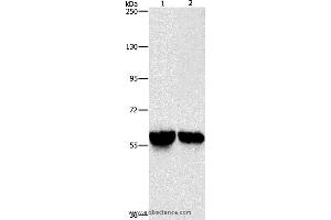 Western blot analysis of Mouse liver and kidney tissue, using ALDH8A1 Polyclonal Antibody at dilution of 1:800 (ALDH8A1 抗体)