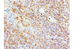 Immunohistochemistry of paraffin-embedded human tonsil tissue using ABIN7144041 at dilution of 1:100 (Amyloid beta (A4) Precursor Protein-Binding, Family B, Member 1 Interacting Protein (APBB1IP) (AA 1-150) 抗体)