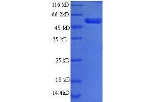 SDS-PAGE (SDS) image for phosphoglycerate Dehydrogenase (PHGDH) (AA 2-251), (partial) protein (GST tag) (ABIN7479282)