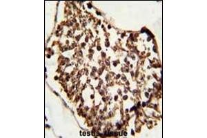 Formalin-fixed and paraffin-embedded human testis tissue reacted with SET07 Antibody, which was peroxidase-conjugated to the secondary antibody, followed by DAB staining. (SETD8 抗体  (N-Term))