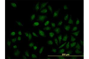 Immunofluorescence of monoclonal antibody to NR1H4 on HeLa cell. (NR1H4 抗体  (AA 363-472))