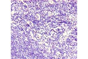 Immunohistochemistry of paraffin-embedded human lymph node tissue using ABIN7148573 at dilution of 1:100 (Corneodesmosin 抗体  (AA 40-229))
