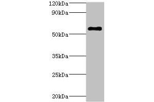 Western Blotting (WB) image for anti-ATPase, H+ Transporting, Lysosomal 56/58kDa, V1 Subunit B2 (ATP6V1B2) (AA 262-511) antibody (ABIN7175229)