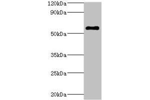 Western blot All lanes: ATP6V1B2 antibody at 5 μg/mL + Hela whole cell lysate Secondary Goat polyclonal to rabbit IgG at 1/10000 dilution Predicted band size: 57 kDa Observed band size: 57 kDa (ATP6V1B2 抗体  (AA 262-511))